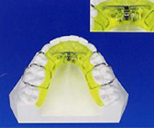 子供に使用する装置の画像2