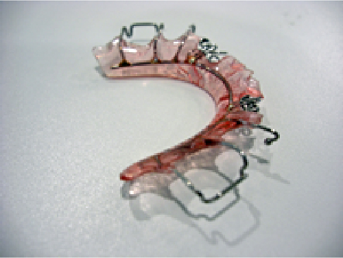 取り外し式プレート装置